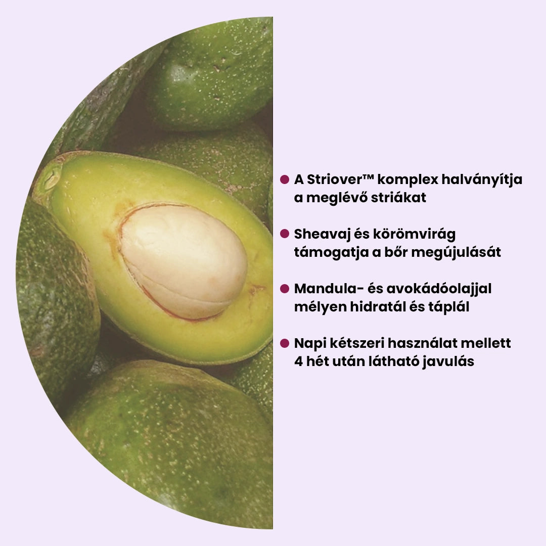 SKINS StriaStop Stria Elleni Krém Striover™ Hatóanyaggal 200ml